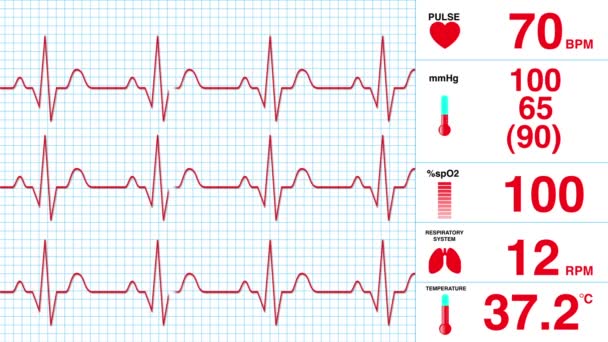 EKG képernyő - Felvétel, videó