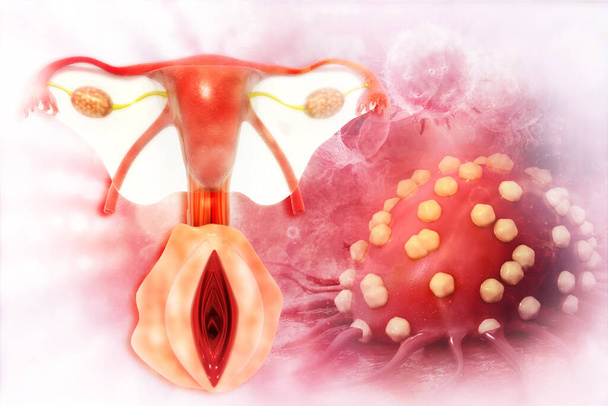 câncer uterino ilustração 3d - Foto, Imagem