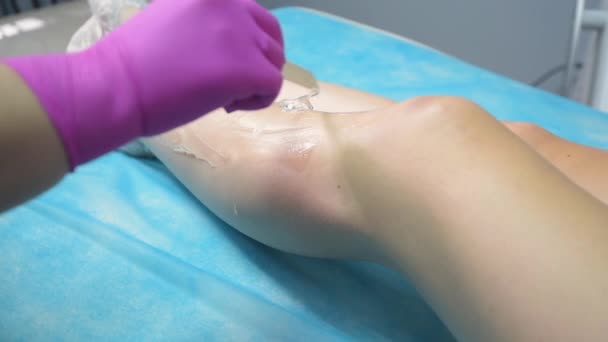 Preparación para la depilación con láser de diodo. La aplicación de un gel con espátula desechable en las piernas de los clientes antes del tratamiento de depilación láser en el salón de cosmetología - Metraje, vídeo