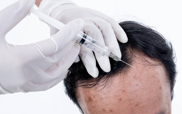 Вид сверху изображения человека, получающего лечение с помощью инъекций сыворотки на коже вокруг головы, в которой у него проблемы с выпадением волос и лицо акне на белом фоне гламурной концепции. - Фото, изображение