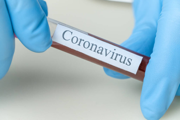 Le mani femminili in guanti blu tengono una provetta di sangue con le parole Coronavirus davanti a loro. Concetto di medicina, analisi - Foto, immagini