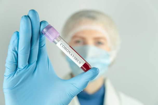 Mulher de vestido médico, boné médico e luvas azuis segura um tubo de teste de sangue com as palavras Coronavirus na frente dela. Conceito de medicamento, análises - Foto, Imagem