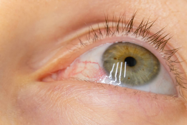 Nahaufnahme des grünen Auges einer Frau mit geplatzten Blutgefäßen, Makrofotografie - Foto, Bild