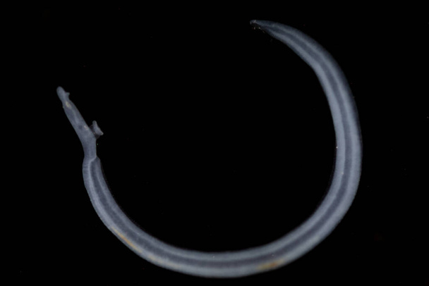 住血吸虫(Schistosoma)はトレマトーデス属の一種で、一般的に研究室での教育のための血煙として知られている。. - 写真・画像
