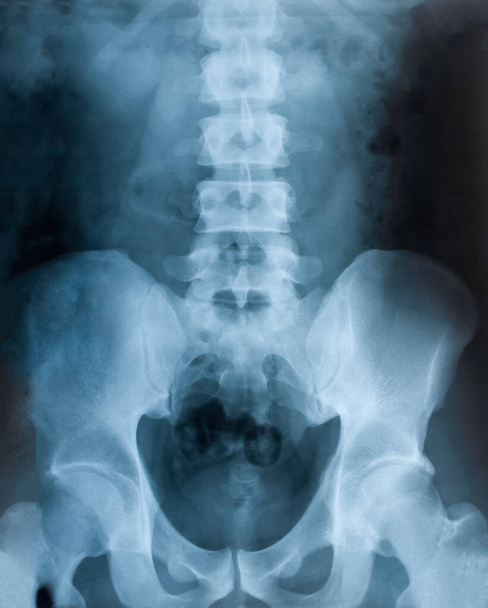 骨盤のX線フィルム,健康診断 - 写真・画像
