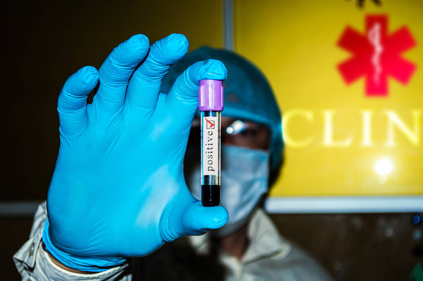 Un profesional médico sostiene un tubo de prueba de sangre de cerca - Foto, imagen