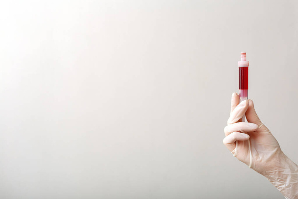 Blood test in tube for laboratory analysis in doctors hand. Laboratory analysis, biochemical blood tests, medical tests studies.White background with copy space.Medicine,healthcare, medical insurance - Φωτογραφία, εικόνα