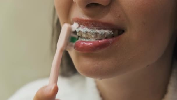 Cerrar mujer limpiando los dientes con aparatos ortopédicos con cepillo de dientes rosa. Limpieza de soportes, higiene dental.  - Imágenes, Vídeo
