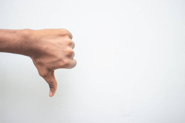 Na rozdíl od konceptu neúspěšných gest - mužská ruka ukazuje, že na bílém pozadí je odříznutý palec dolů. Ruční symbol znakový jazyk. - Fotografie, Obrázek