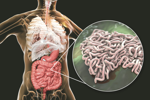 Parasitic worms in human intestine, 3D illustration. Ascaris lumbricoides and other round worms - Photo, Image