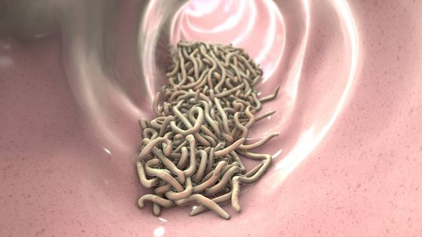 Parasitic worms in the lumen of intestine, 3D illustration. Ascaris lumbricoides, Enterobius vermicularis, and other round worms - Photo, Image