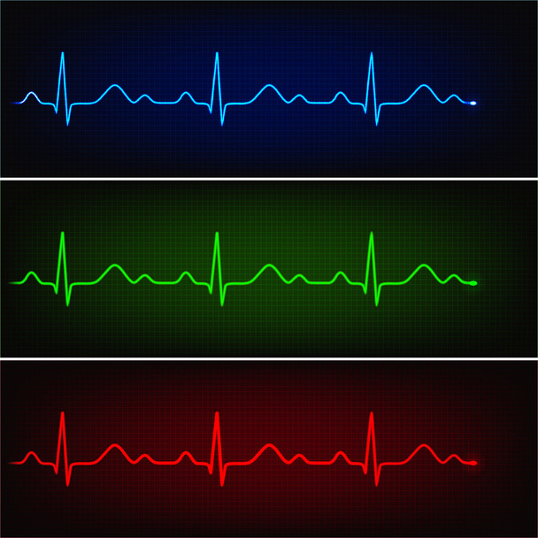 Cardiogram of heart stop and death - Vector, Imagen