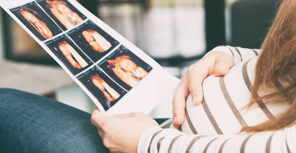 The pregnant woman is looking on the photo of her child making by ultrasound - Photo, image