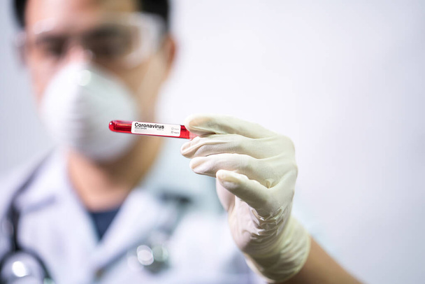 Doctor Hand holding test tube. Asian doctor holding Coronavirus (COVID-19) bloods sample tube and nCoV-19 folder in lab. Selective focus. - Φωτογραφία, εικόνα