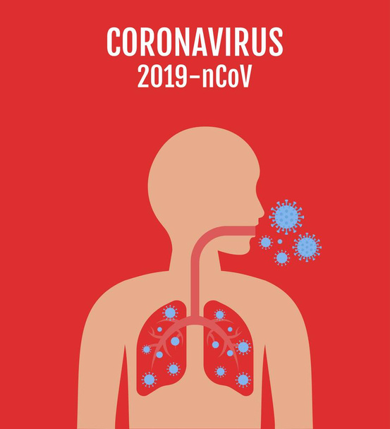 Wuhan coronavirus covit 19 lié, caractère humain, maladie pulmonaire ou virus infecté poumons et bactéries dangereux pour la santé vecteurs illustration à plat - Vecteur, image