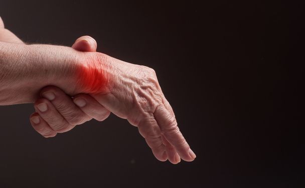 Senior hands. Suffering from pain and rheumatism - 写真・画像