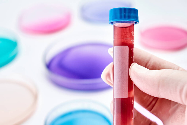 Blood sample in a plastic test tube on the background of Petri dish with colorful liquids or media. Microbiology or chemical research.  - Φωτογραφία, εικόνα