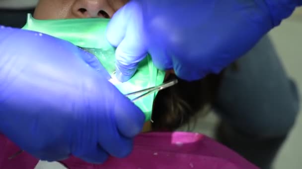 Пацієнт у кріслі в кабінеті стоматолога проводить стоматологічні процедури, лікування зубів
. - Кадри, відео