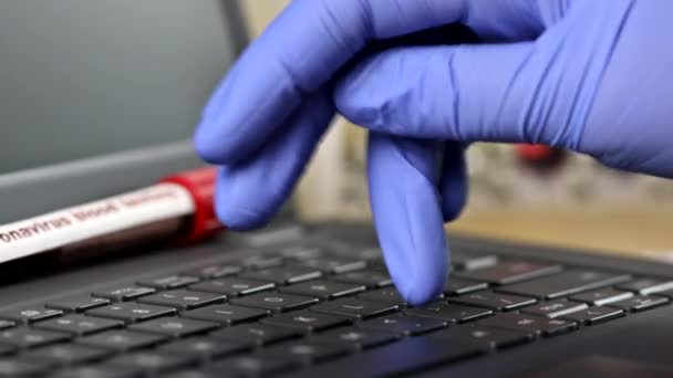 Büro des Krankenhauses im Labor arbeitet an computergestütztem medizinischem Personal bei Bluttests - Filmmaterial, Video