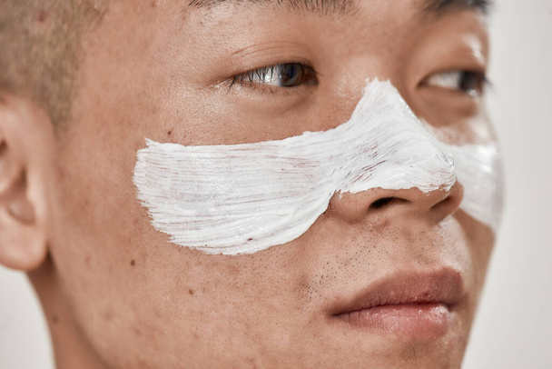 Közelkép fiatal ázsiai férfi arcát problémás bőr és hyperpigmentatio alkalmazott maszk az arcán, nézett félre elszigetelt fehér háttér. Szépség, bőrápolás rutin - Fotó, kép