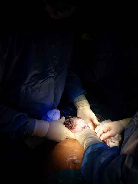 porodnice v momentě, kdy žena porodí - císařský řez - dívku s sekundami života - Fotografie, Obrázek