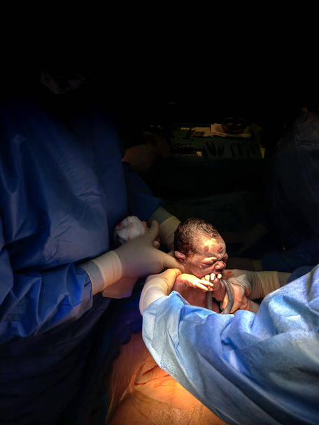 Entbindungs-Operationssaal in dem Moment, in dem eine Frau entbunden hat - Kaiserschnitt - ein Mädchen mit Sekunden bis zur Liv - Foto, Bild