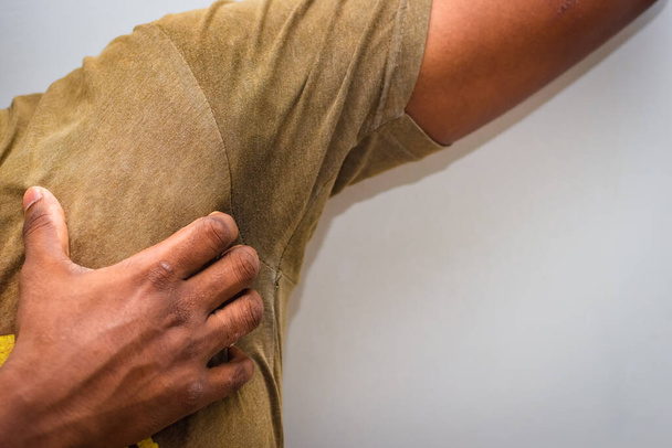 Svědění kožních onemocnění - Muž používá ruku k poškrábání podpaží pro svědění kůže. Není to nic na práci na veřejných místech. - Fotografie, Obrázek