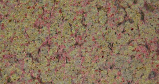 Aivolisäkkeen poikkileikkaus mikroskoopilla pimeässä kentässä 100x - Materiaali, video