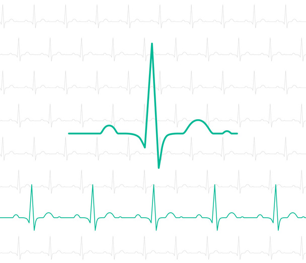 EKG símbolo en blanco - fondo médico vectorial
 - Vector, imagen