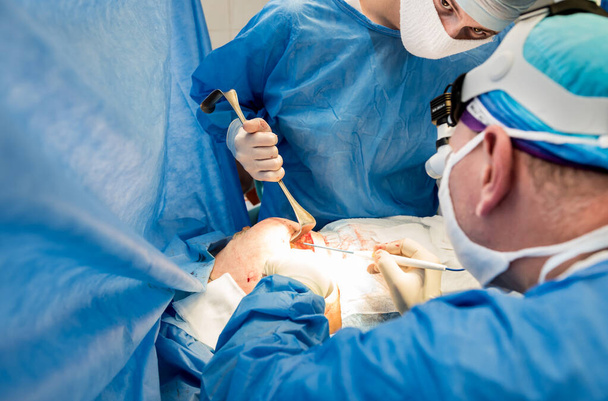 Χειρουργική επέμβαση για την αφαίρεση του μαστού και την αντικατάστασή του με εμφύτευμα. - Φωτογραφία, εικόνα