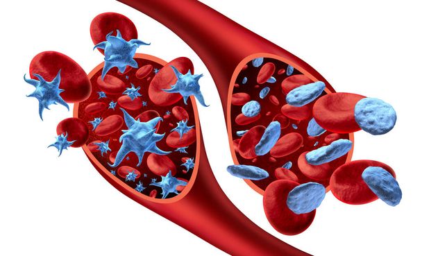 Platelet and non-activated platelets in the blood and thrombocyte anatomy concept as activated platelets flowing in an artery or vein as a 3D render. - Photo, image