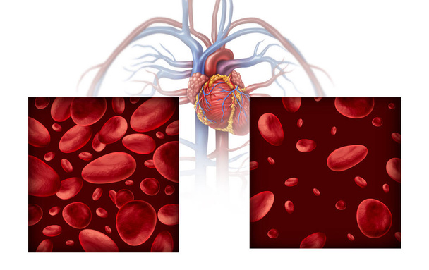Anemia and anaemia medical diagram concept as normal and abnormal blood cell count and human circulation in an artery or vein as a 3D illustration on a white background. - Photo, Image