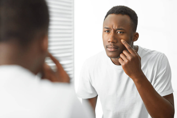 Huolestunut musta kaveri koskettaa akne kasvot seisoo kylpyhuoneessa - Valokuva, kuva