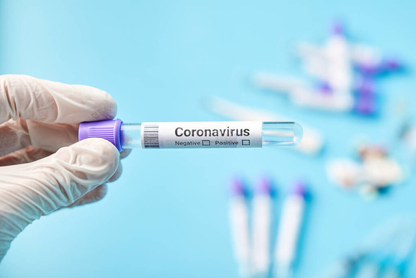 Campione di tubi medici per l'analisi del coronavirus, ricerca di laboratorio per creare il vaccino contro un nuovo virus covid-19. - Foto, immagini