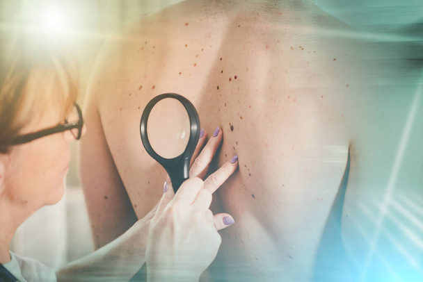 Дерматолог, осматривающий кожу на спине пациента; множественное воздействие - Фото, изображение