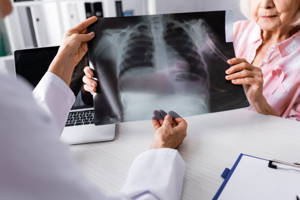 Vista ritagliata del paziente con nastro rosa e medico che tiene i raggi X vicino al computer portatile - Foto, immagini