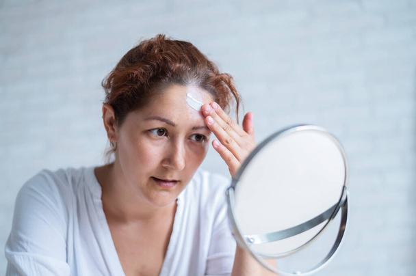 Portrait of a Caucasian woman with vitiligo uses sunscreen. A girl with a white pigment spot on her forehead looks in the mirror and is smeared with cream. - Photo, Image
