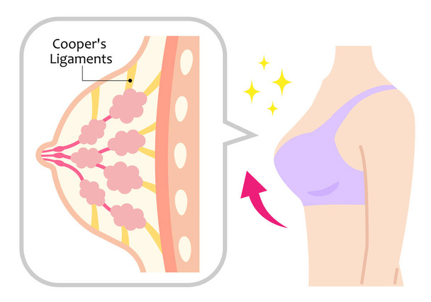 diagram of sagging breasts and womans body illustration. beauty body and health care concept - Vector, Image