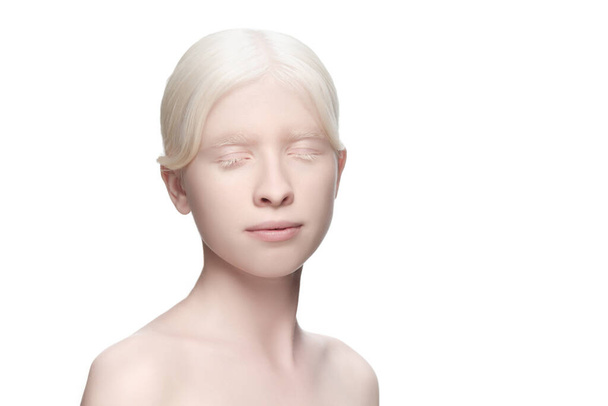 Portrait of beautiful albino woman isolated on white studio background. Beauty, fashion, skincare, cosmetics concept. - Foto, Imagen