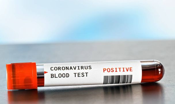 Sample vial with blood, label says coronavirus test, positive result.  (sticker is own design, dummy barcode). Covid-19 outbreak concept - Foto, afbeelding