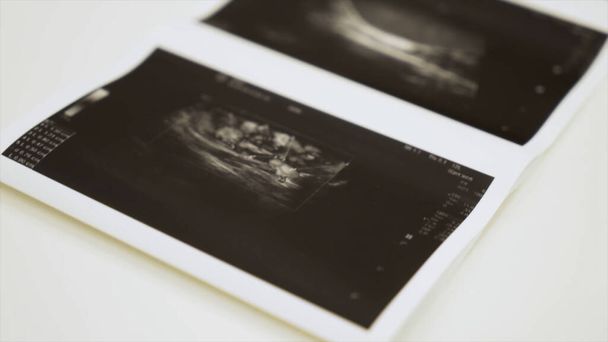 Sammlung von Bildern aus Ultraschalluntersuchungen. Handeln. Nahaufnahme monochromer Bilder interner menschlicher Organe, Konzept der Medizin. - Foto, Bild