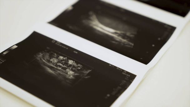 Collection of images from ultrasound scan examination. Action. Close up of monochrome images of internal human organs, concept of medicine. - Photo, Image