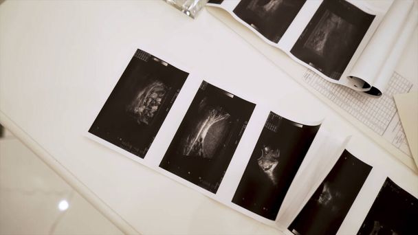 Close up of ultrasound images lying on white table background. Action. Concept of health care and medicine, black and white images of medical diagnostics. - Photo, Image