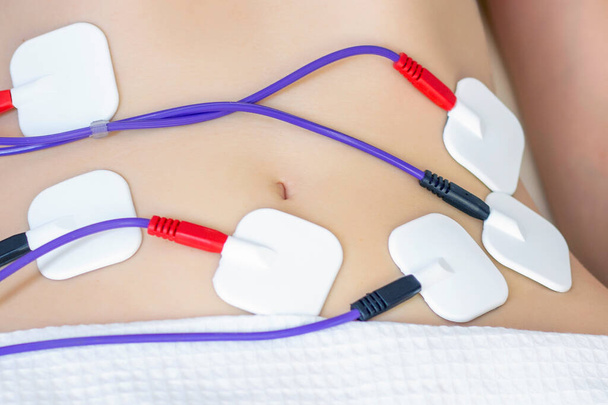 Myostimulation electrodes are placed on the abdomen. Anti-cellulite massage myostimulation for a beautiful female figure. - Fotó, kép