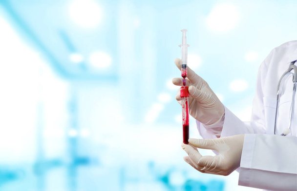 Mão de médica mulher em casaco branco e luva médica segurando seringa com tubo de teste de sangue para testes em laboratório de hematologia no hospital - Foto, Imagem