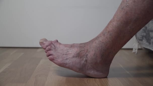 Close-up van oude zieke vrouwelijke voeten met kromme tenen en lange enge nagels. Seniorenvoeten naakt met zere tenen. Grote zeer oude benen van een oudere gepensioneerde niet getrimd gele verschrikkelijke nagels - Video