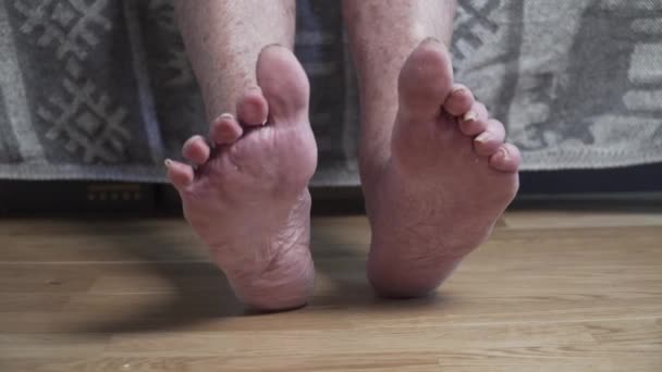 Wunde Fußnägel Nahaufnahme unkenntlich Person, alter Mann. Eine arme Frau menschliche Füße sehen beängstigend und schrecklich mit langen, ungeschnittenen Nägeln. Faltig gefleckte Beine ältere Hündin - Filmmaterial, Video