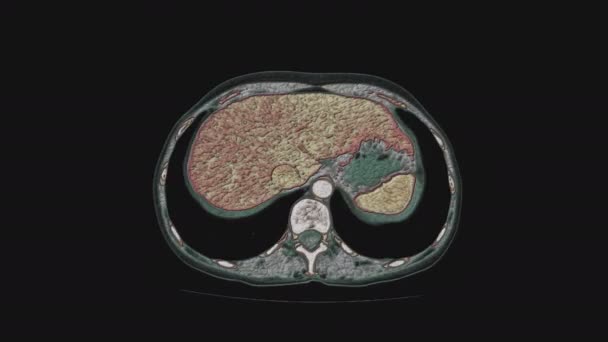 IRM multicolore en vrac des organes pelviens féminins, cavité abdominale, tractus gastro-intestinal et vessie - Séquence, vidéo
