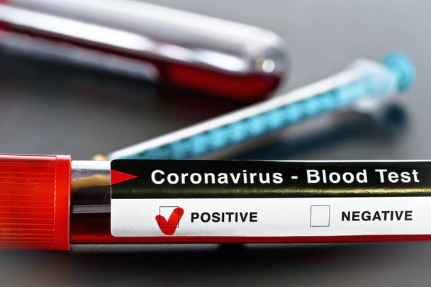 Sample medical vial with blood, label says coronavirus test, positive result. Blurred syringe near. Covid-19 testing during outbreak concept - Photo, image