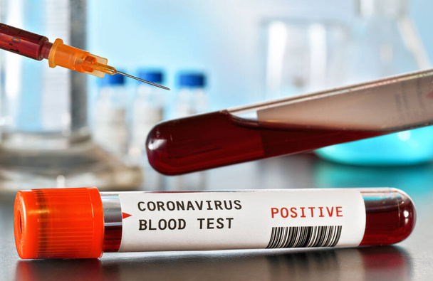 Sample vial with blood, label says coronavirus test, positive result, hypodermic syringe needle above. Blurred laboratory equipment background. Covid-19 testing during outbreak concept - Foto, Imagem